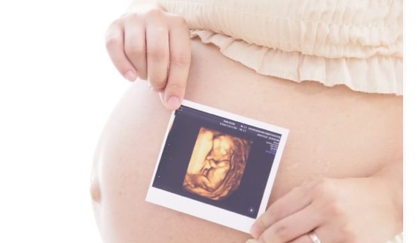 DEAR STUDIO ｈａｎａｒｅの撮影写真1