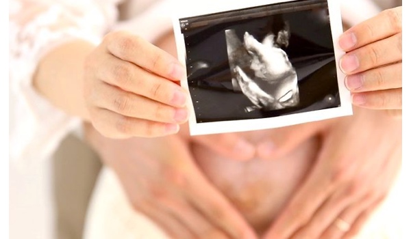 DEAR STUDIO ｈａｎａｒｅの撮影写真3